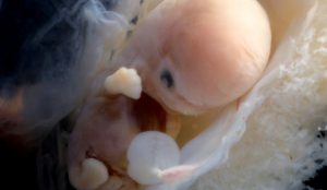 Embryo in der 6. Woche